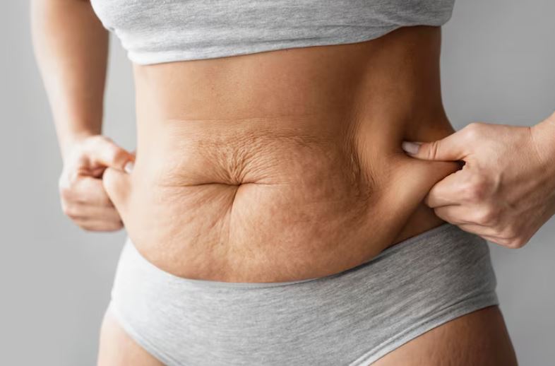 best treatment for tummy tuck in south mumbai
